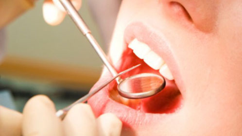 Посещение стоматолога убережет от болезней сердца